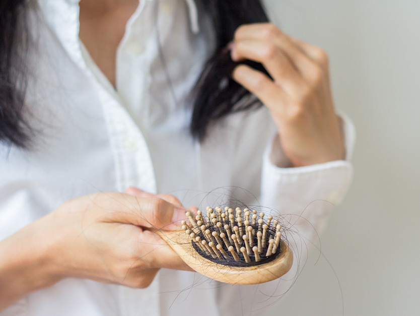 caduta capelli donne